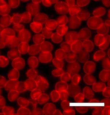 red blood cells From Wikimedia Commons