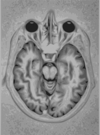 תמונת MRI של מח אנושי תמונת MRI של מח אנושי