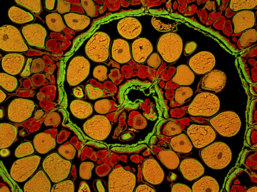 An image that won fourth place in the Worcester Institute's scientific photography competition