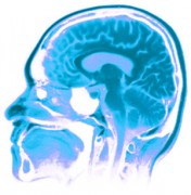 סריקת MRI של המוח. מתוך אתר מכון פרנקלין