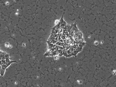Stem cells. Photo: University of California