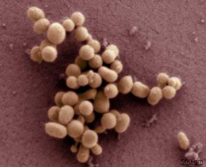 החיידק המסונתז M. mycoides JCVI-syn1 של מכון קרייג ונטר. צילום במיקרוסקופ אלקטרונים אוניברסיטת קליפורניה בסן דייגו