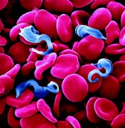 הטפיל Trypanosoma_brucei מוקף תאי דם בדגימת דם נגועה. איור: ürgen Berger and Dr. Peter Overath, מכון מקס פלנק לביולוגיה התפתחותית, גרמניה