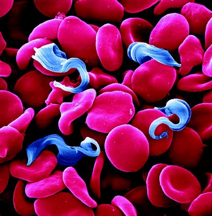 הטפיל Trypanosoma_brucei מוקף תאי דם בדגימת דם נגועה. איור: ürgen Berger and Dr. Peter Overath, מכון מקס פלנק לביולוגיה התפתחותית, גרמניה