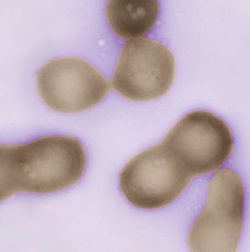 חיידק m-mycoides מסונתז ממעבדתו של קרייג ונטר. צילום: אוניברסיטת קליפורניה בסן דייגו