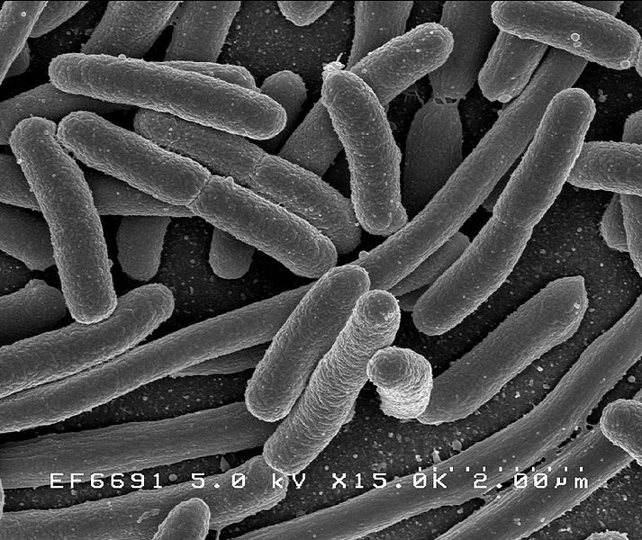תמונת Escherichia coli תחת מיקרוסקופ אלקטרונים סורק