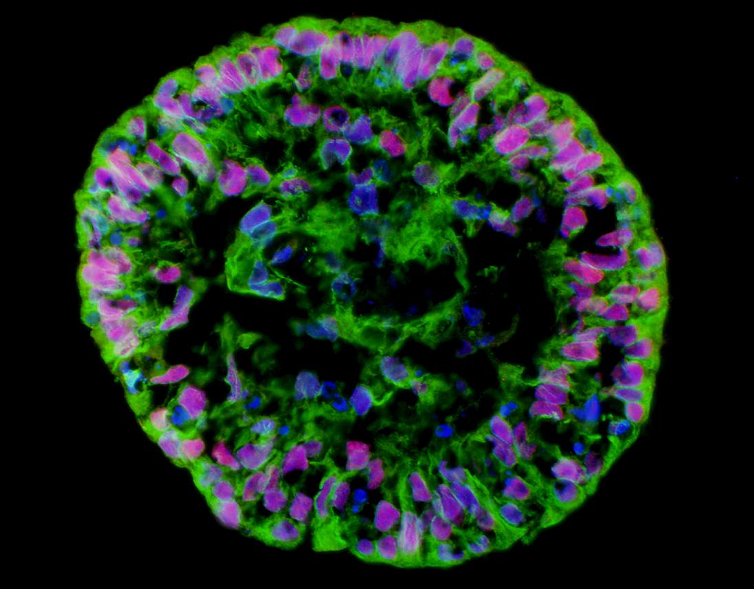 An embryo-like body of human embryonic stem cells, formed when the stem cells are transferred to a liquid medium to form a suspension. The origin of the colors are the markers of different cells originating from the three layers of the germ. Photographed with a light microscope at x20 magnification. Courtesy of Prof. Nissim Benvanisti, Hebrew University