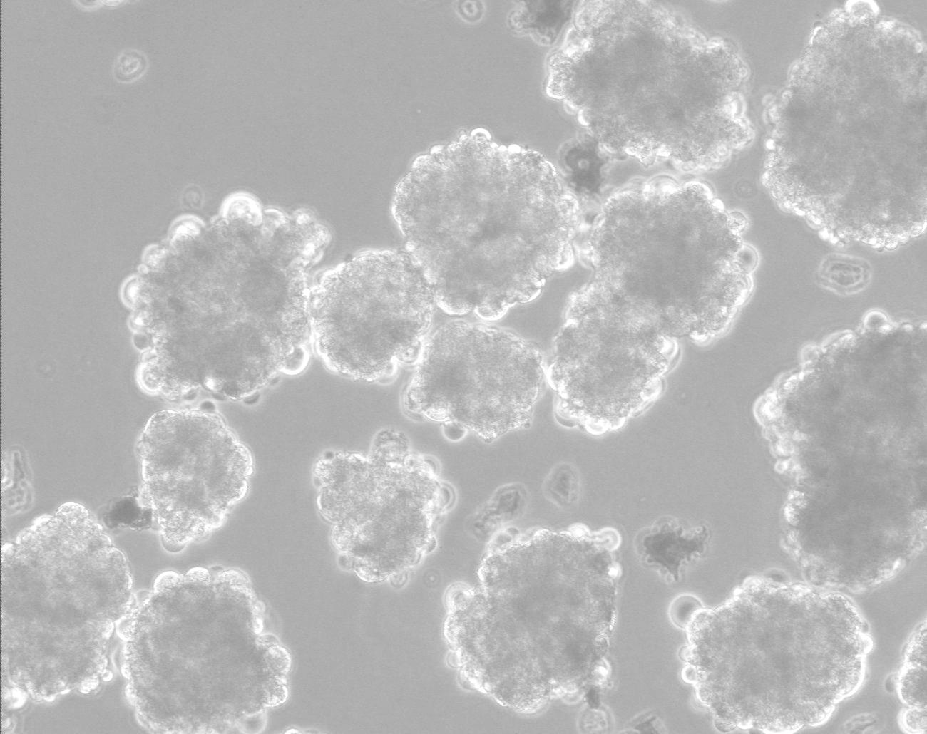 איור 4 צברים של תאי גזע עובריים אנושיים בתרחיף. באדיבות פרופ' בנימין ראובינוף וד"ר דבורה שטיינר