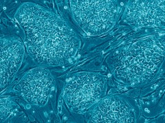 איור 3 תרבית של תאי גזע עובריים אנושיים הגדלים על מצע של תאי פיברובלסט שמקורם בעכבר. תאי המצע גדולים עשרות מונים מתאי הגזע העובריים. צולם במיקרוסקופ אור בהגדלה של פי 20. באדיבות פרופ' נסים בנבניסטי, האוניברסיטה העברית