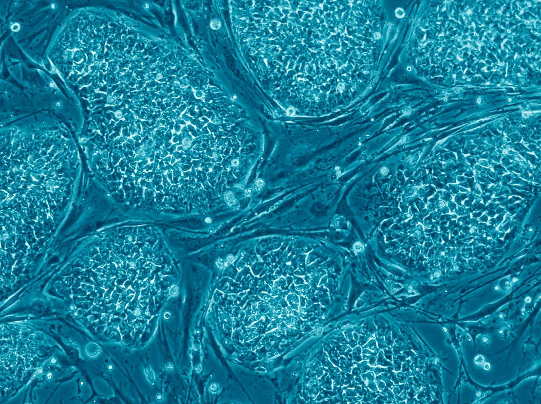 איור 3 תרבית של תאי גזע עובריים אנושיים הגדלים על מצע של תאי פיברובלסט שמקורם בעכבר. תאי המצע גדולים עשרות מונים מתאי הגזע העובריים. צולם במיקרוסקופ אור בהגדלה של פי 20. באדיבות פרופ' נסים בנבניסטי, האוניברסיטה העברית