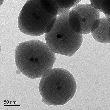 ננו-חלקיקי הסיליקה המכילים ליבה מגנטית יעילים המשחררים תרופות בהתאם לפעולה מרחוק של הרופאים. צילום במיקרוסקופ אלקטרונים, UCLA
