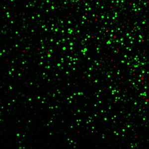 Microscope field of prostate cancer cells after exposure to laser-activated carbon nanoparticles
