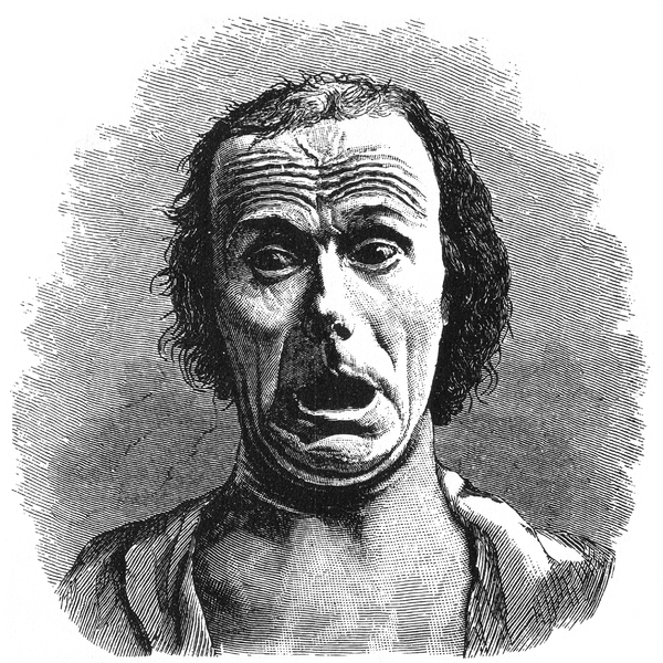 A face expressing fear from the book "The expressions of fear in mother and beast" written by Darwin