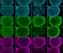 תאי גזע גדלים על מצע סינתטי. צילום: MIT