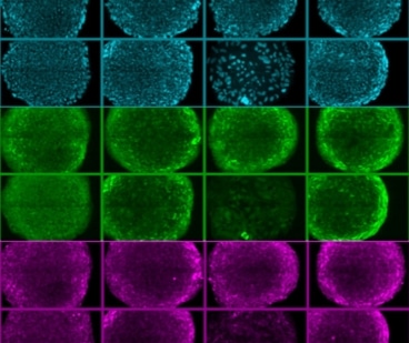 Stem cells are grown on a synthetic medium. Photo: MIT