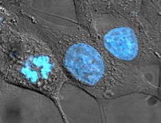 תאי HeLa שנצבעו בצביעת הכסט הצובעת את גרעין התא שלהם בכחול
