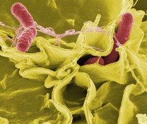 חיידקי Salmonella typhimurium (באדום) חודרים לתרבית תאים אנושית. מתוך ויקיפדיה