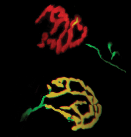 צביעה של אזורי המפגש בין תאי עצב (ירוק) לשריר (אדום). הצביעה הצהובה מייצגת חפיפה מלאה בין תאי העצב לשריר בעכברים נורמליים (למטה). בעכברים מהונדסים, החסרים מיקרו-אר-אן-אי בתאי עצב המעצבבים שרירים, ניכרת צביעת השריר בלבד (למעלה, באדום), משום שהעצב באיזור המפגש חולה. איור: מכון ויצמן