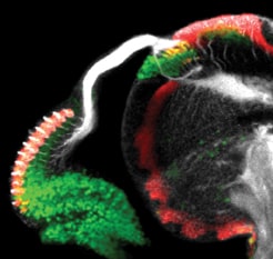 A stage in the development of the eye of the Drosophila fly. The nerve extensions of the nerve cells in the eye pass from the eye (left) through the optic stalk, and connect to the optic lobe in the brain