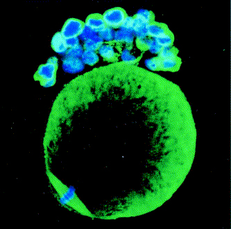 A rat egg cell. Courtesy of Prof. Nava Dekel, Weizmann Institute of Science