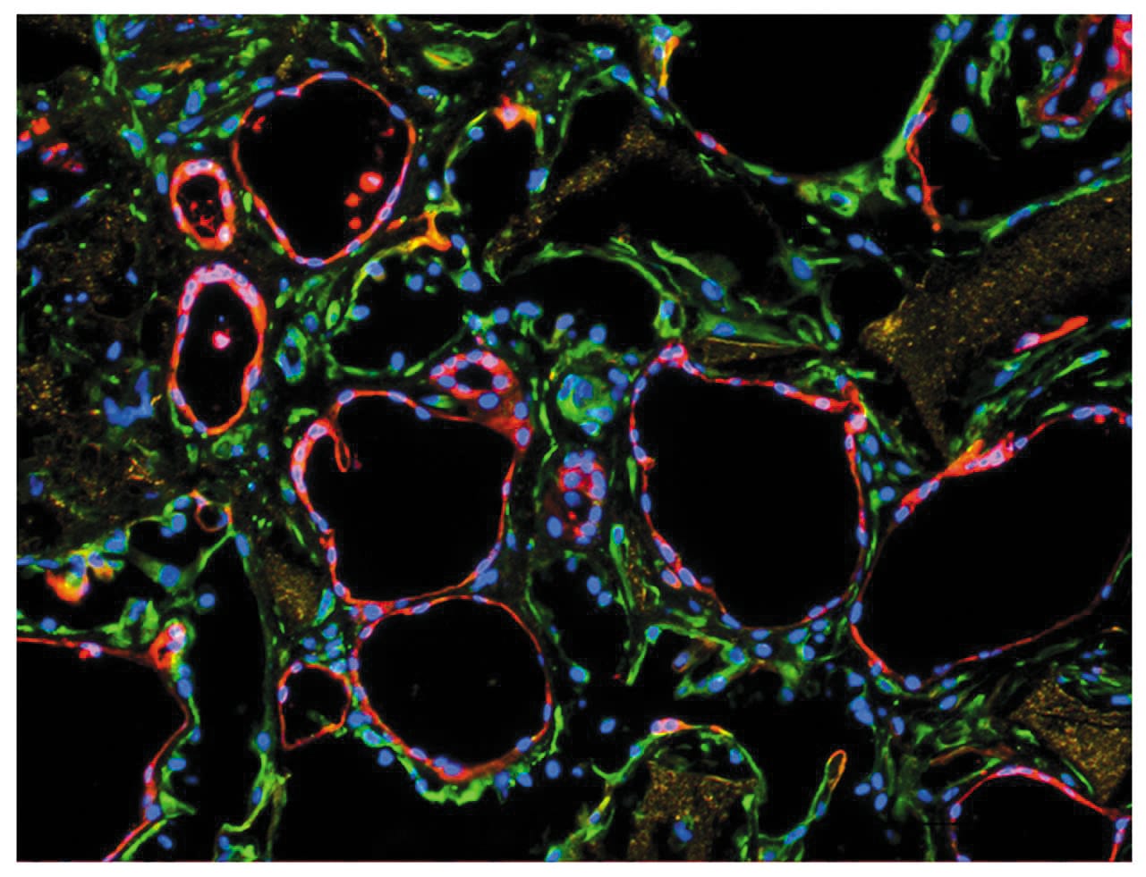 Stem cells. Photo: Technion