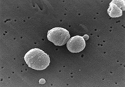 The pneumococcus bacterium. From Wikipedia