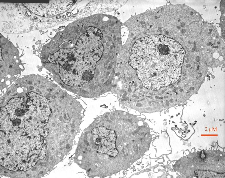 تصوير الخلايا باستخدام المجهر الإلكتروني المخترق. الصورة: ويكيبيديا
