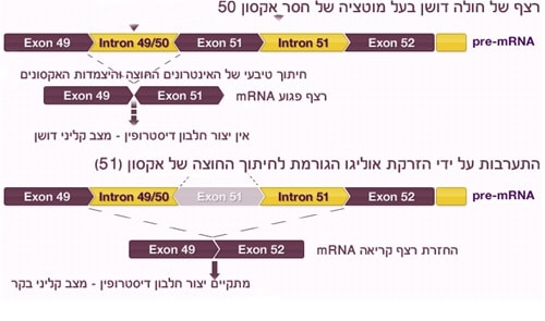 רצף pre-mRNA של חולה דושן בעל מוטצית חוסר באקסון 50 הגורמת לפגיעה ברצף הקריאה של הגן על ידי דילוג על אקסון 51 מוחזר רצף הקריאה ל- mRNA.