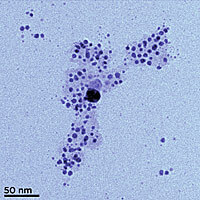 A transmission electron microscope (TEM) image of silver nanoparticles formed from silver ions in a solution containing humic acid. The acid tends to envelop the nanoparticle (visible in the image as a light background) and prevent it from accumulating together with other nanoparticles.