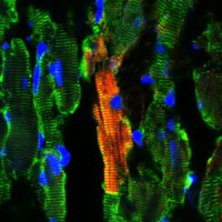 תא גזע תופס מקום של תאי שריר לב פגומים. איור: יוניברסיטי קולג' לונדון