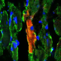 A stem cell takes the place of damaged heart muscle cells. Illustration: University College London