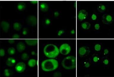 Cooperation between the proteasome and the lysosome. Photo: Weizmann Institute of Science