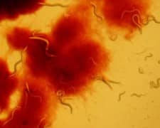 תולעי סי אלגנס בצלחת פטרי - אלו שהתרבו מינית שרדו טוב יותר