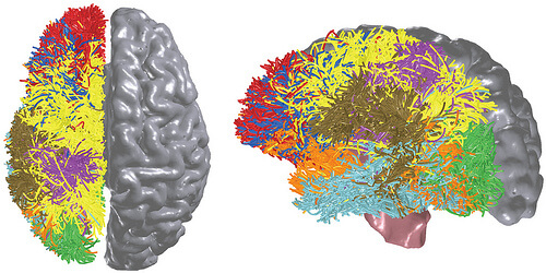 הדמיית המוח האנושי בסיוע מחשב על של יבמ. איור: אוניברסיטת סטנפורד