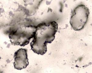 מאובנים מיקרוסקופיים בני 3.4 מיליארד שנה שהתגלו במערב אוסטרליה. צילום: אוניברסיטת מערב אוסטרליה ואוניברסיטת אוקספורד