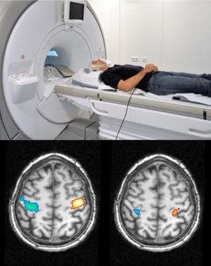Brain scan using fMRI to read dreams