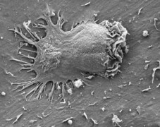 מיקרוסקופ אלקטרונים של תאים אפקטורים המחדירים רגליים דרך הקרום של תאי אנדותל. צילום: פרופ' רונן אלון, מכון ויצמן