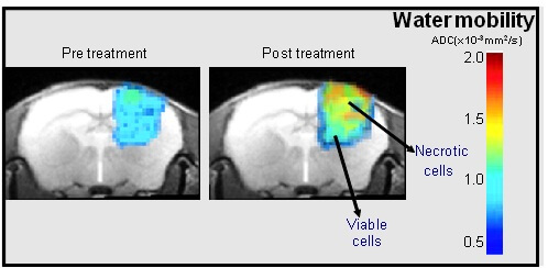 איור 2 האזורים הצבועים מעידים על צפיפות התאים בגידול הסרטני (במוח של עכבר כמודל לסרטן המוח). לאחר טיפול (מימין) ישנה ירידה בצפיפות התאים.