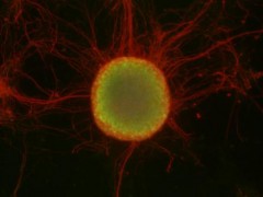 מושבה של תאי גזע (במרכז, בירוק), מוקפת בתאי עצב (באדום). צילום: מכון ויצמן