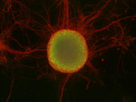 A colony of stem cells (in the center, in green), surrounded by nerve cells (in red). Photo: Weizmann Institute