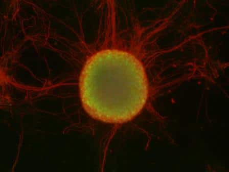 A colony of stem cells (in the center, in green), surrounded by nerve cells (in red). Photo: Weizmann Institute