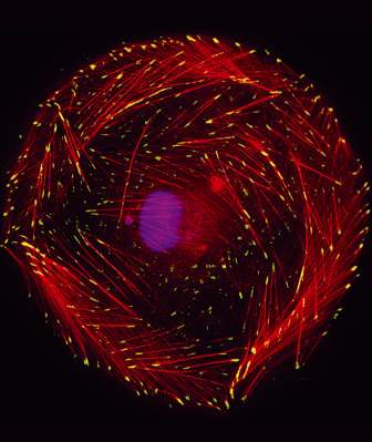 خلية غير قطبية، بعد ست ساعات من زرعها على سطح بوليمري ناعم. النقاط الصفراء تشير إلى بروتين "باكسيلين" الذي يلعب دورا في مناطق الاتصال المستهدفة، وألياف الأكتين ملونة باللون الأحمر، ونواة الخلية ملونة باللون الأرجواني. الصورة: معهد وايزمان