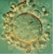 ביצית בשלה מוכנה להפריה. סביב הביצית - תאי הזקיק. צילום: פרופ' אלכס צפרירי, מכון ויצמן