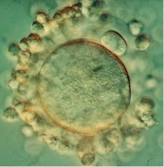 A mature egg is ready for fertilization. Around the egg - the follicle cells. Photo: Prof. Alex Tzafariri, Weizmann Institute