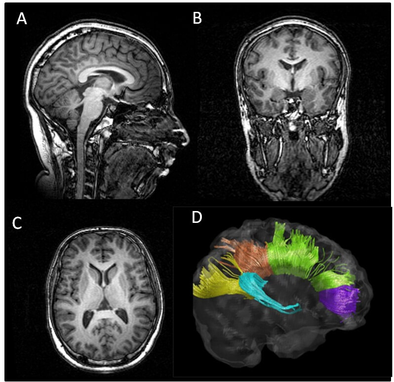 محاكاة تأثير المخدرات على الدماغ بإذن من Bioimage