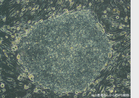 מושבת תאי גזע עובריים מושרים Credit: Haruhisa Inoue's Laboratory, CiRA, Kyoto University)