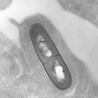 A scanning electron microscope image of the Listeria bacterium