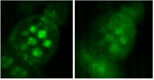 תמונה מיקרוסקופית של תאים שנעשתה באמצעות שיטת המיקוד הטמפורלית (משמאל) או ללא מיקוד טמפורלי (מימין)