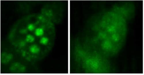 Microscopic image of cells taken using the temporal focus method (left) or without temporal focus (right)