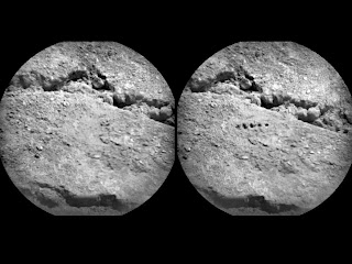 טיפול בלייזר בסגנון מאדים: משמאל- לפני, מימין- אחרי